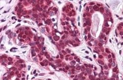 SMVT/SLC5A6 Antibody, Novus Biologicals 50 &mu;g; Unconjugated:Antibodies,